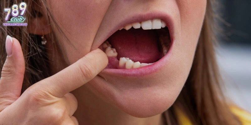 Mơ thấy rụng răng thường là dấu hiệu cảnh báo quan trọng