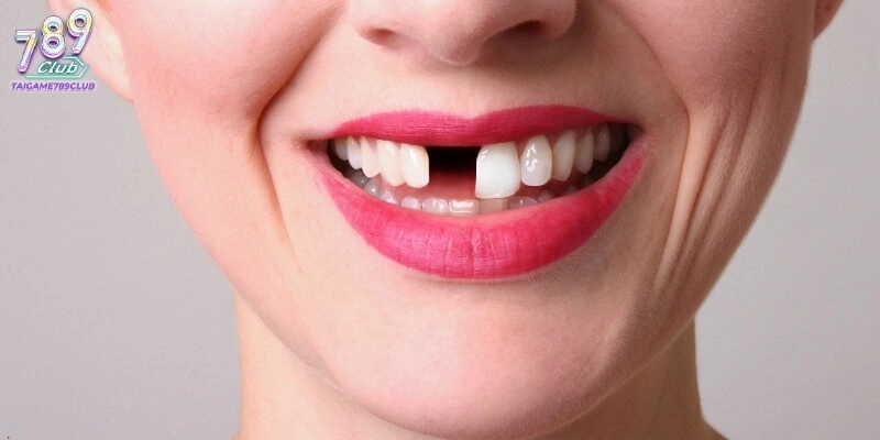 Nằm mơ rụng răng đánh con gì thường mang ý nghĩa may mắn