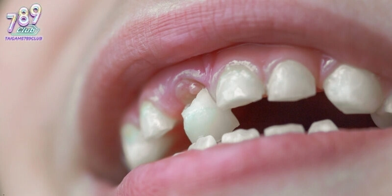 Nằm mơ rụng răng đánh con gì nên kết hợp nhiều hình thức cược